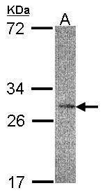 IL22 Receptor alpha 2 Rabbit Polyclonal Antibody