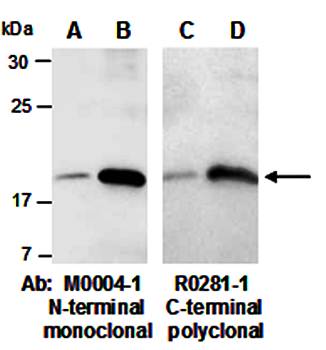 IL-22 (C) Antibody, Rabbit Polyclonal