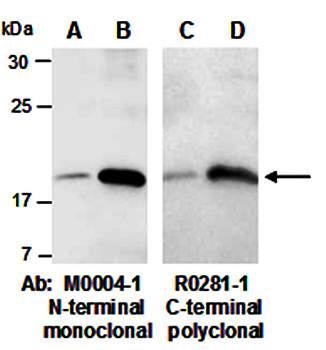 IL22 antibody