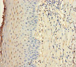 IL22RA1 Antibody