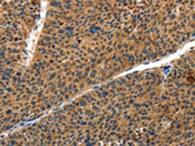 IL22RA1 Antibody