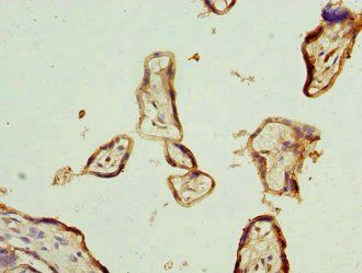 IL22RA2 Antibody