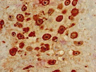 IL22RA2 Antibody