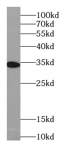IL22RA2 antibody