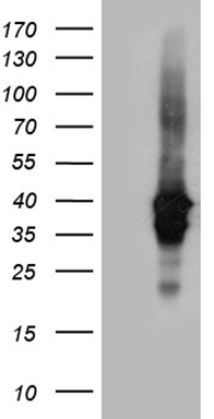 IL23 Receptor Antibody