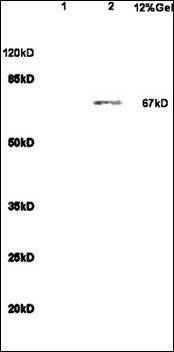 IL23 Receptor antibody