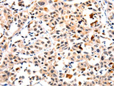 IL23R Antibody