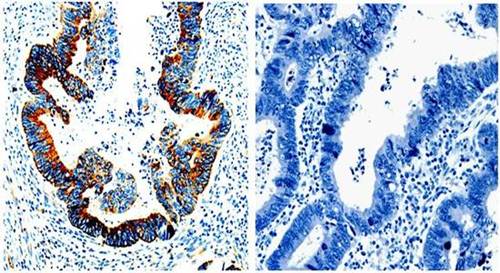 IL23R Antibody