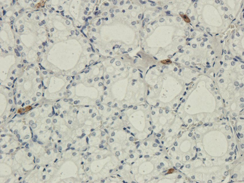 IL26 antibody