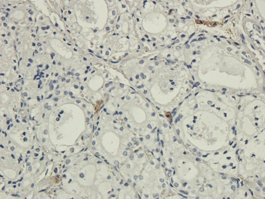 IL26 Rabbit Polyclonal Antibody