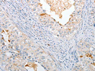 IL27 Antibody