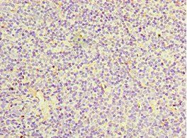 IL27RA Antibody