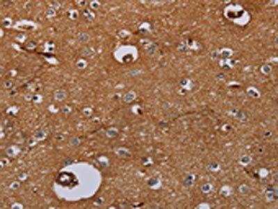 IL27RA Antibody