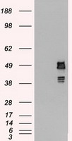 IL28 Receptor alpha Antibody