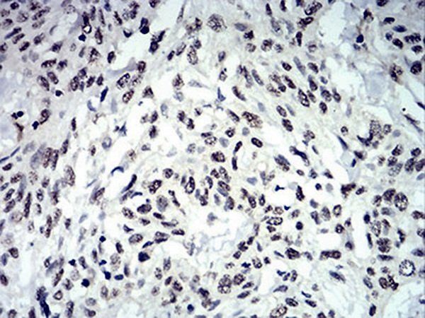 IL28A Antibody