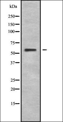 IL28RA antibody