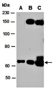 IL2RB antibody