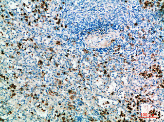 IL31 antibody