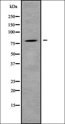 IL31R antibody