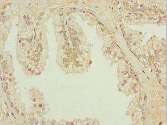 IL31RA antibody