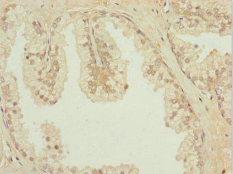 IL31RA Antibody