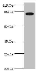 IL31RA antibody