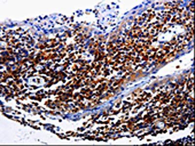 IL31RA Antibody