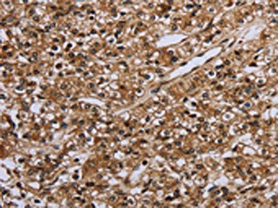 IL31RA Antibody