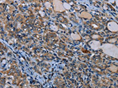 IL31RA Antibody