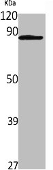 IL31RA antibody