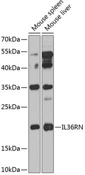 IL36RN antibody