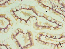 IL37 antibody