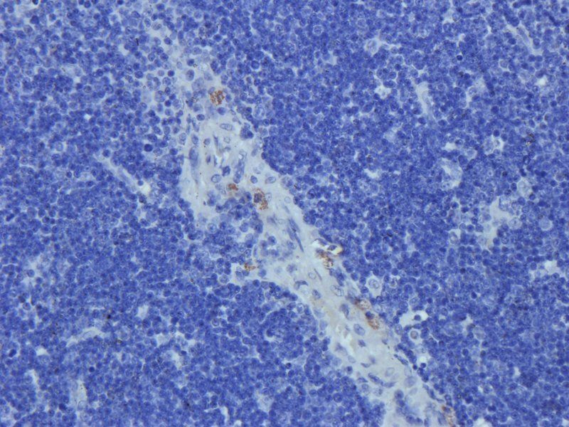 IL4 Rabbit Polyclonal Antibody