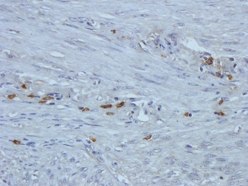 IL4 Rabbit Polyclonal Antibody