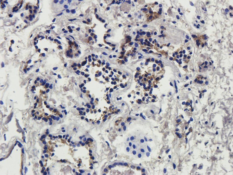 IL4 antibody