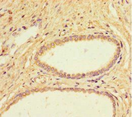 IL4I1 Antibody