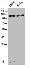 IL4R Antibody