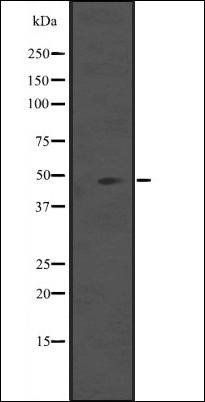 IL5RA antibody
