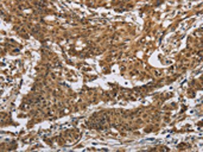 IL5RA Antibody