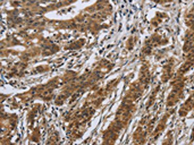 IL5RA Antibody
