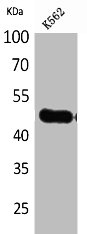 IL5RA antibody