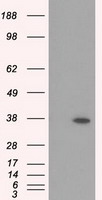 IL6 antibody