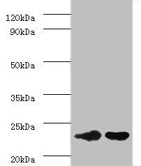 IL6 antibody