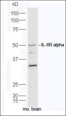 IL6 alpha Receptor antibody