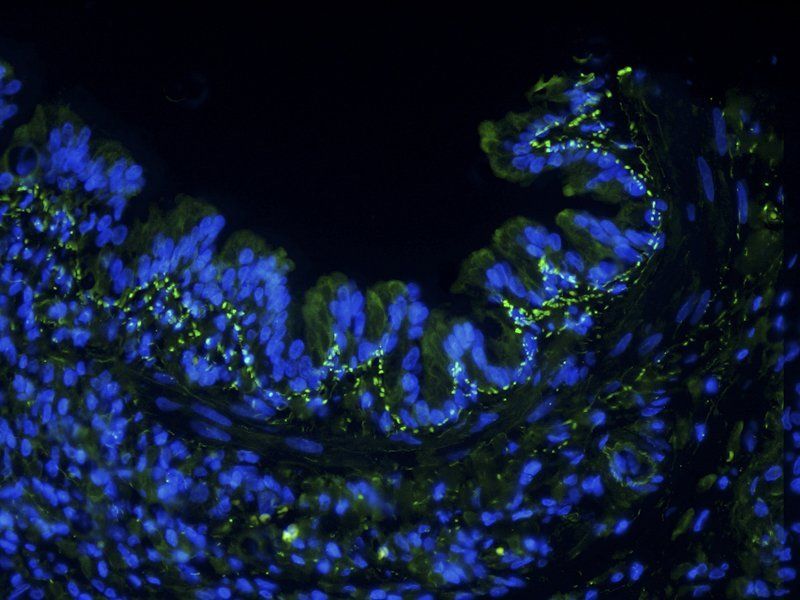 IL6 antibody (FITC)