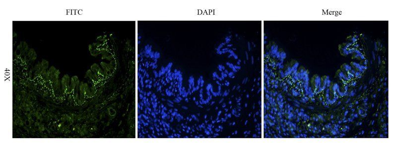 IL6 Rabbit Polyclonal Antibody (FITC)