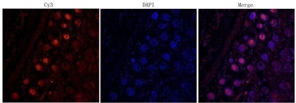 IL6 antibody