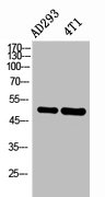 IL6R antibody