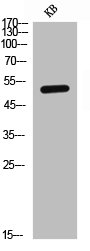 IL7R antibody