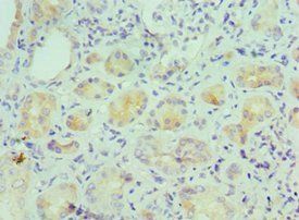 IL9 Antibody
